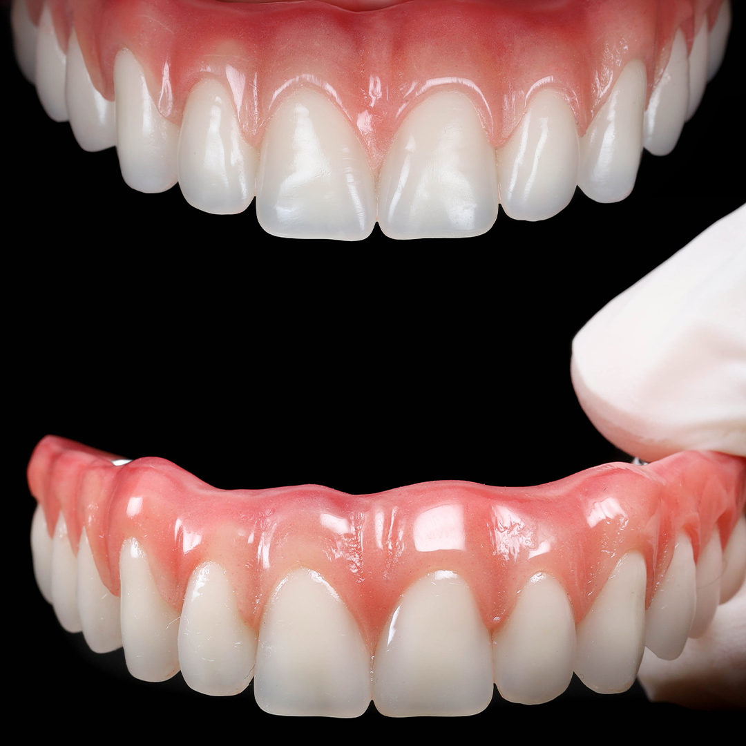 Antes e depois de tratamento odontológico na Ortoface